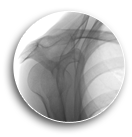 bottom_left